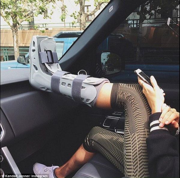 Μέσα σε ένα χρόνο έσπασε το ίδιο πόδι δυο φορές