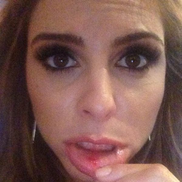 Πόσταρε στο instagram τα δαγκωμένα της χείλη