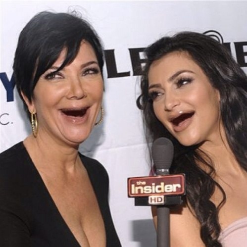 Αν οι σταρ δεν είχαν δόντια!