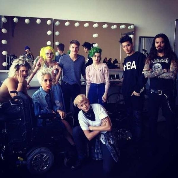 Έχει μυϊκή δυστροφία και όμως έγινε μοντέλο