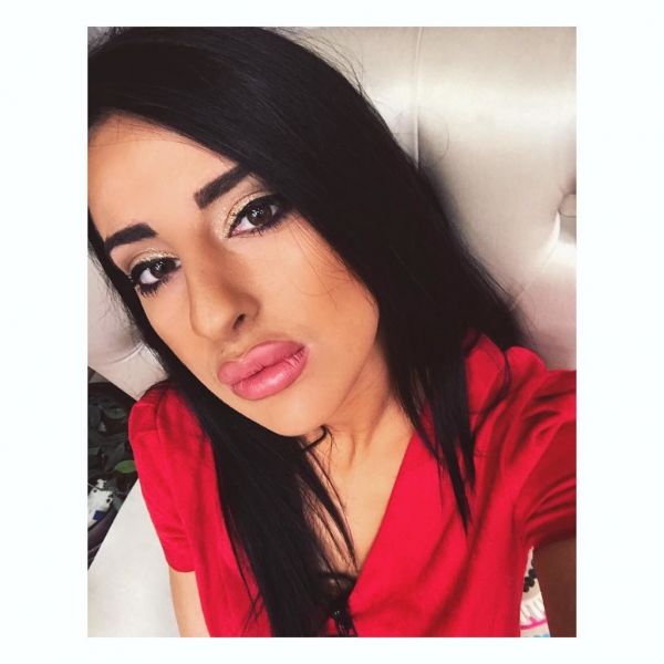  Power of love: Η Τζούλια «φούσκωσε» τα χείλη της! 