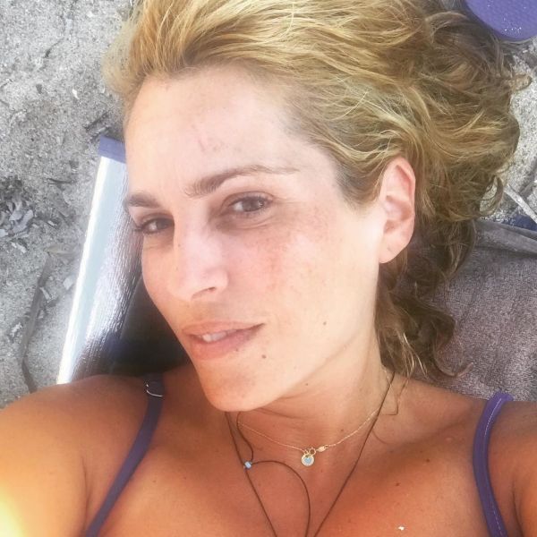 Η Τζένη Μπότση δείχνει πώς είναι το πρόσωπό της χωρίς φίλτρα και μακιγιάζ