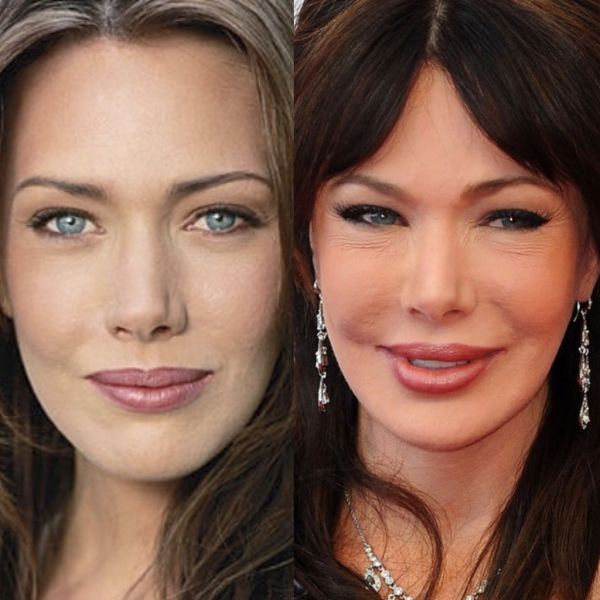 Θα πάθετε πλάκα! Αγνώριστη η Τέιλορ της σειράς «Τόλμη και Γοητεία» μετά τις πλαστικές  