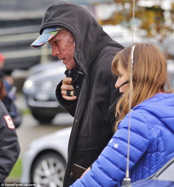 Σοκαριστικές εικόνες! Παραμορφώθηκε το πρόσωπο του Ryan Reyonolds. Με εγκαύματα ο ηθοποιός!