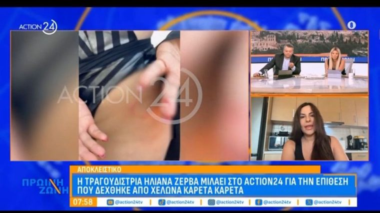 zerva.jpg